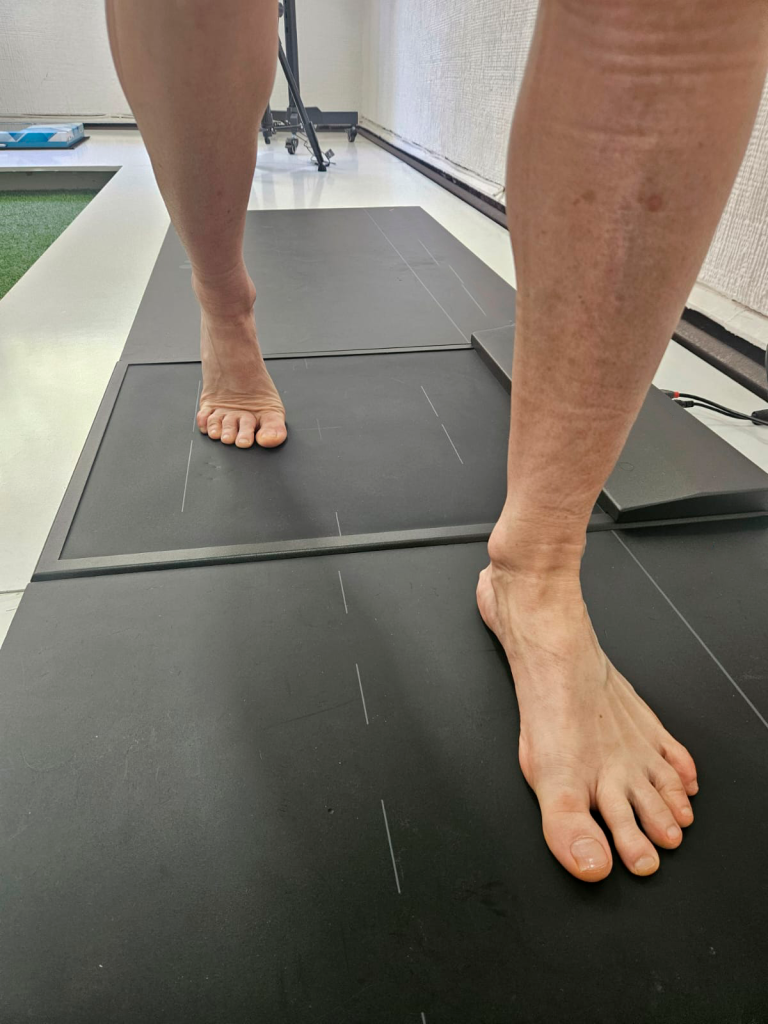 Estudio personalizado de la pisada